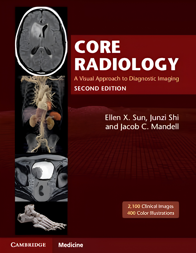 Core Radiology 2nd Edition: Diagnostic Imaging