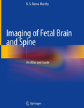 Imaging of the Fetal Brain and Spine: An Atlas and Guide 1st Edition